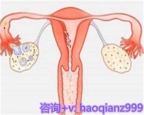 广州供卵代孕